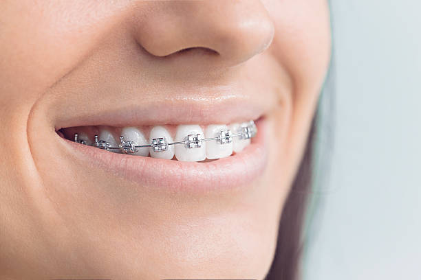 Best Wisdom Tooth Removal  in Delphi, IN